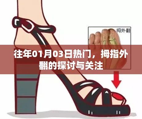 拇指外翻关注度飙升，探讨与关注热潮