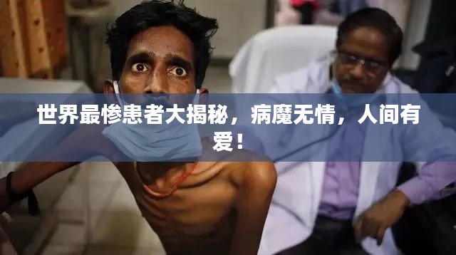 世界最惨患者大揭秘，病魔无情，人间有爱！