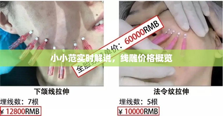 小小范实时解说,线雕价格概览